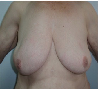 Mamas4
